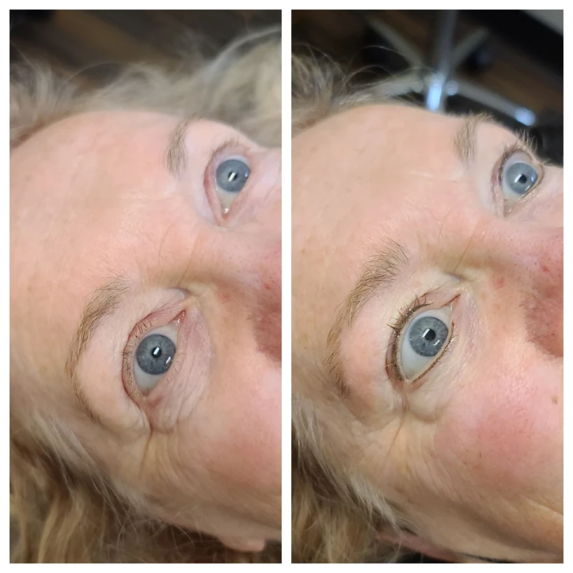 Before and After 18