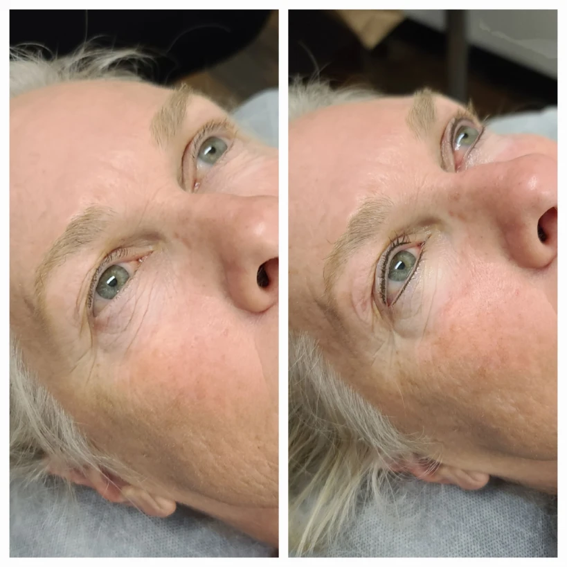 Before and After Permanent Cosmetics Example