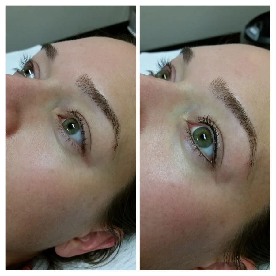 Before and After 21