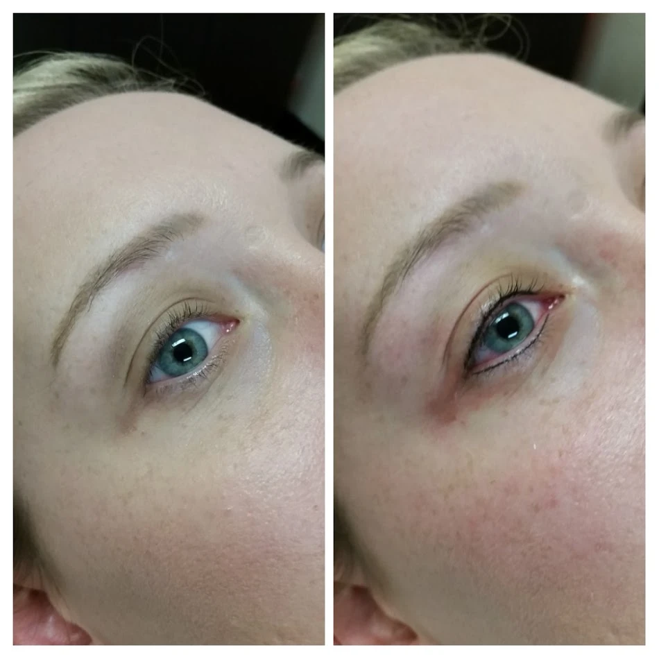 Before and After 12