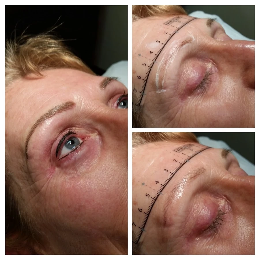 Before and After 10