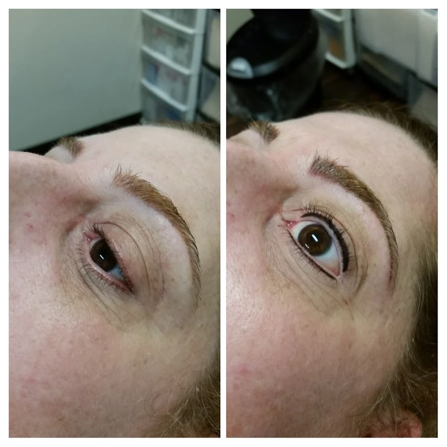 Before and After 22