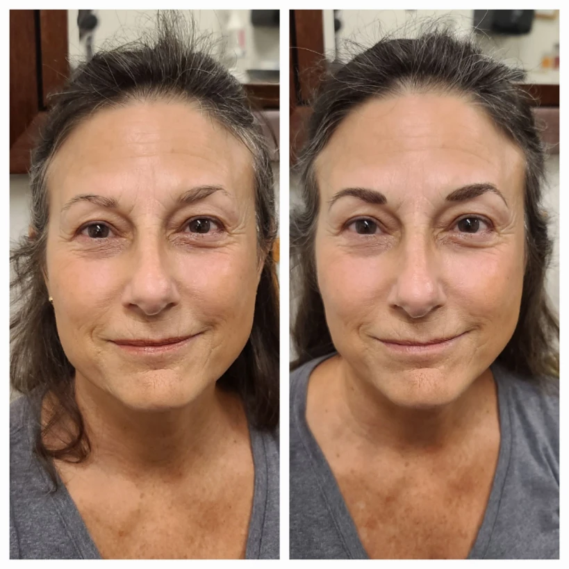 Before and After 3