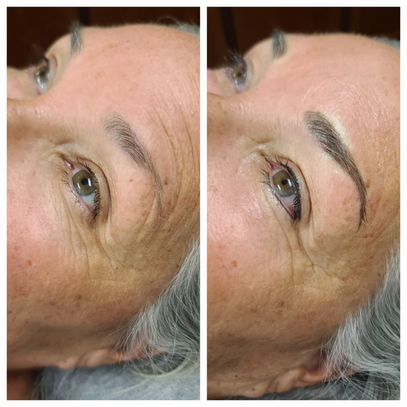 Before and After 17