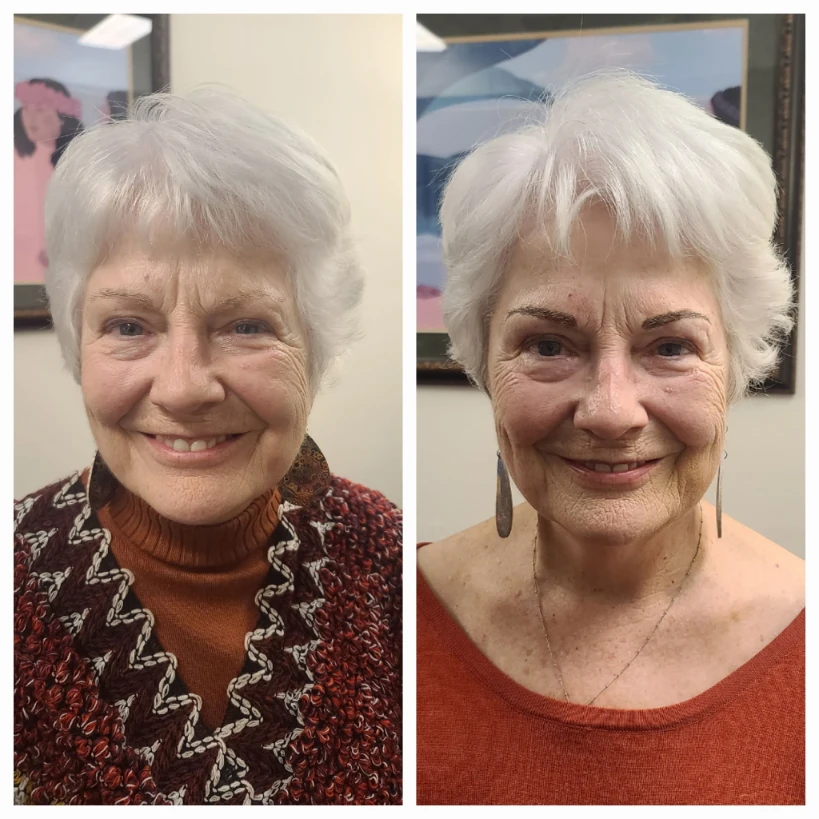 Before and After Permanent Cosmetics Example
