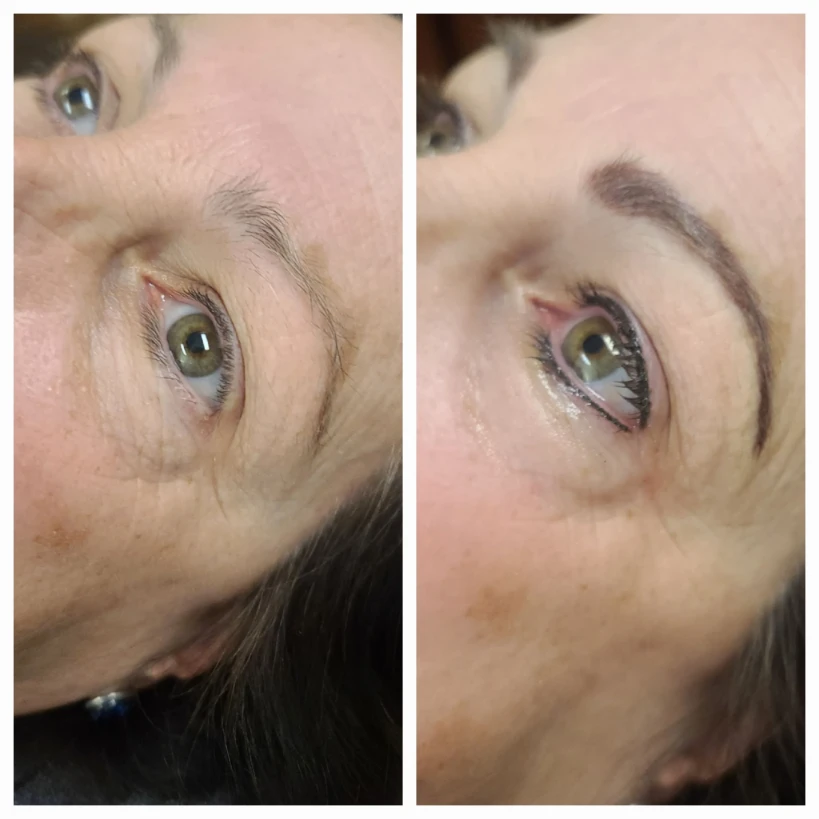 Before and After 16
