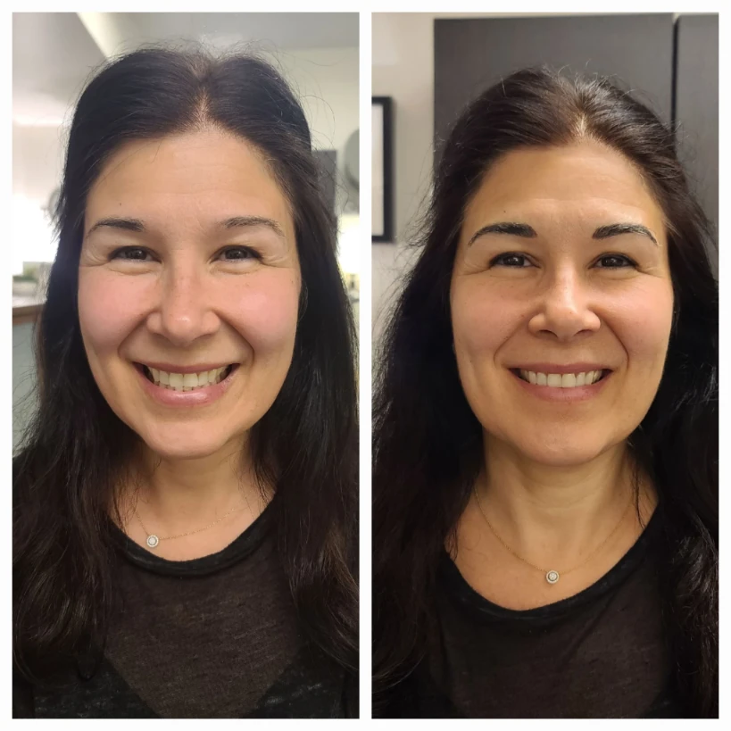 Before and After Permanent Cosmetics Example