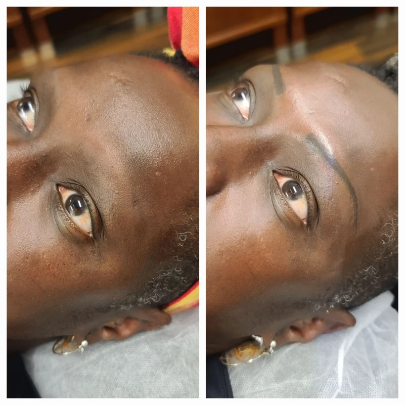 Before and After 9