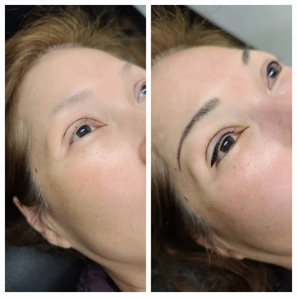 Before and After 7