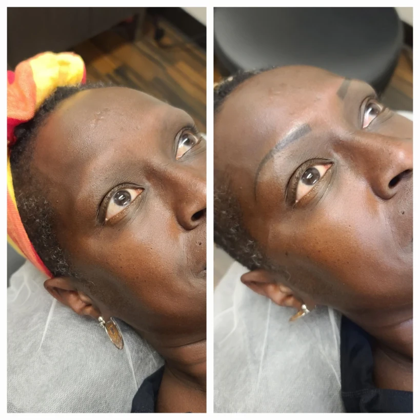 Before and After 13