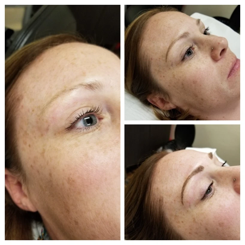 Before and After 14