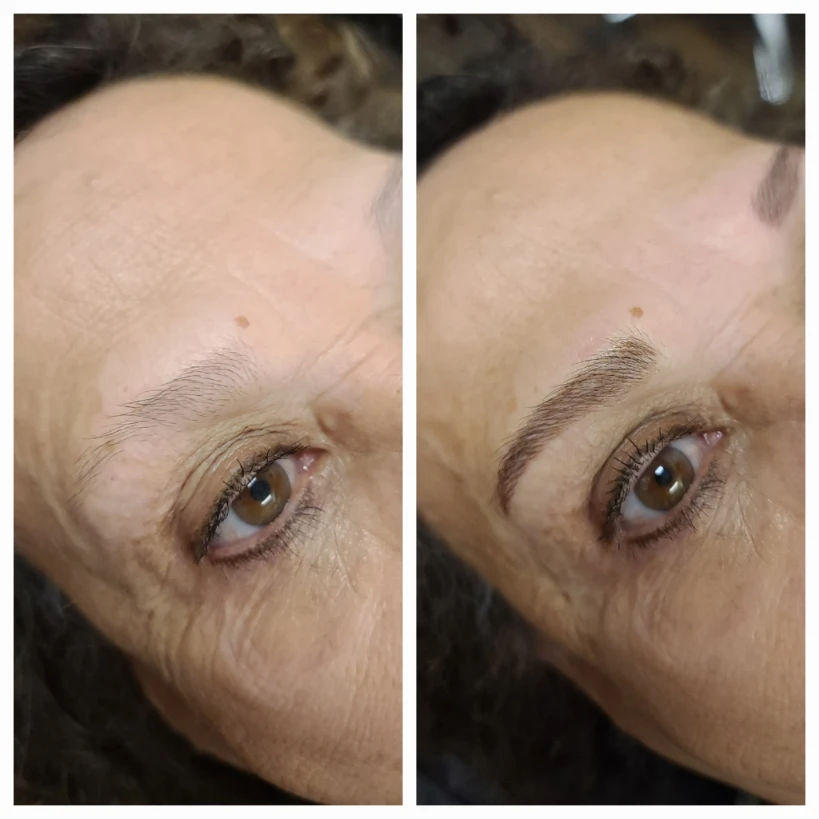 Before and After 24