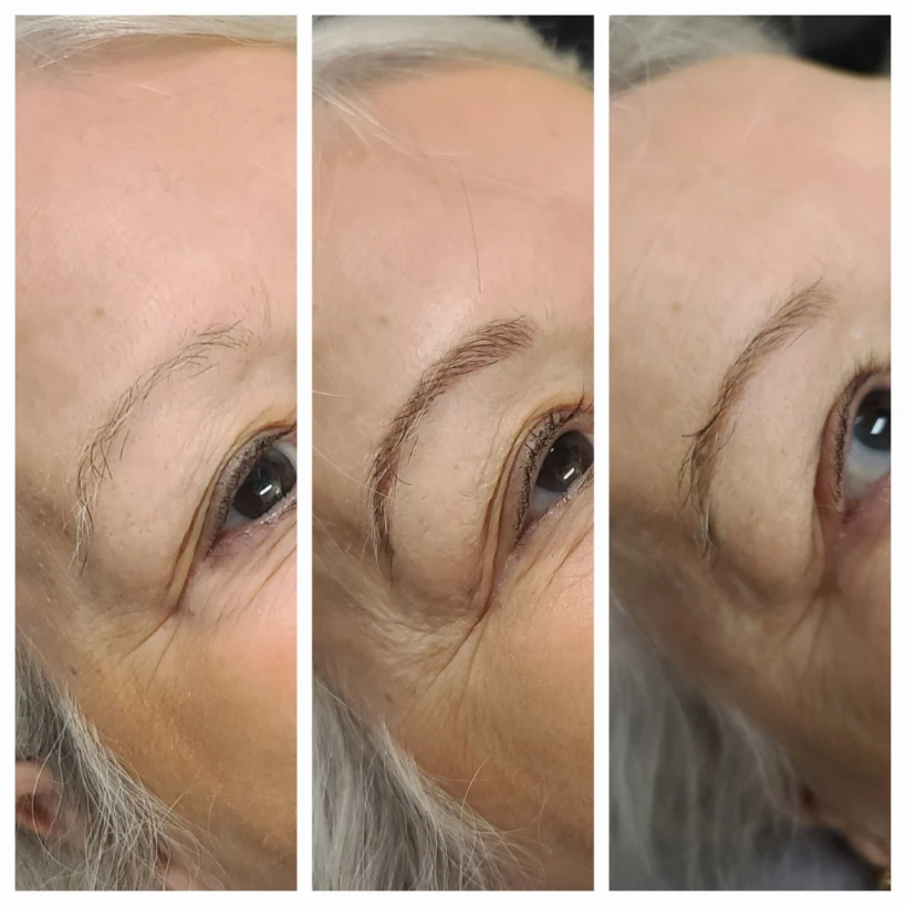 Before and After 6