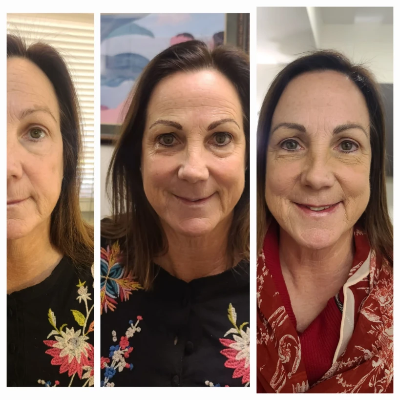 Before and After Permanent Cosmetics Example