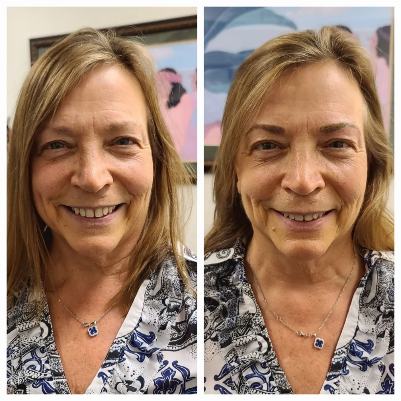 Before and After 15